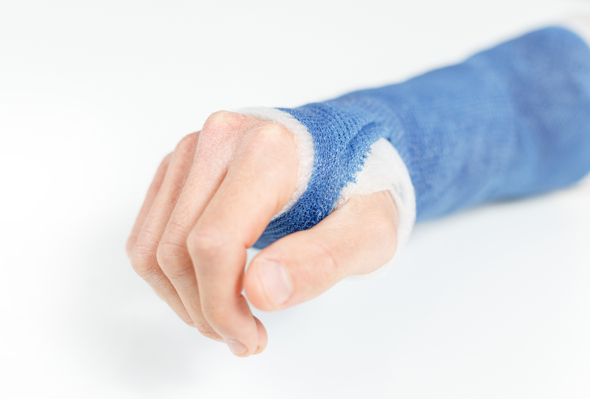 Waterproof Casts – Hand Therapy Centre – Newcastle & Maitland